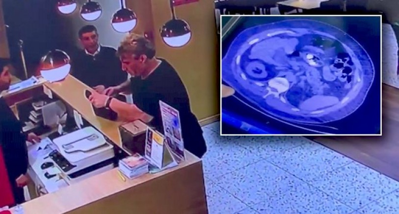 Midesindeki uyuşturucu dolu kapsüller patladı, hayatını kaybetti