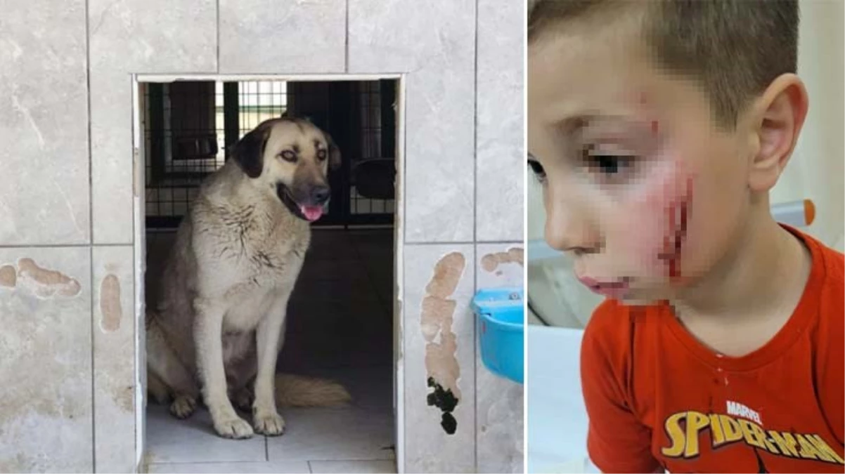Tatil için Türkiye’ye gelen küçük çocuğa, başıboş sokak köpeği saldırdı