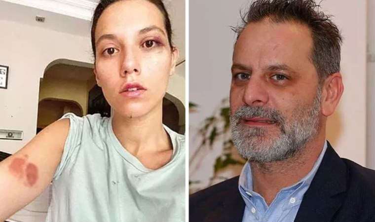 Deniz Bulutsuz’a şiddet uyguladığı iddiasıyla yargılanan Ozan Güven sessizliğini bozdu