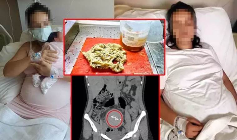 Hukuk mücadelesini başlatacak: Vücudunda unuttukları gazlı bez 2 sene sonra fark edildi