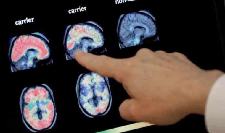 Bilimde ve yaşamda gerçeği görememek