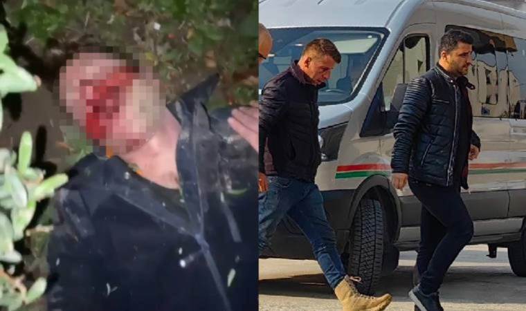 Kaldırım taşı ile darbedilmişti… Arandığı ortaya çıktı!