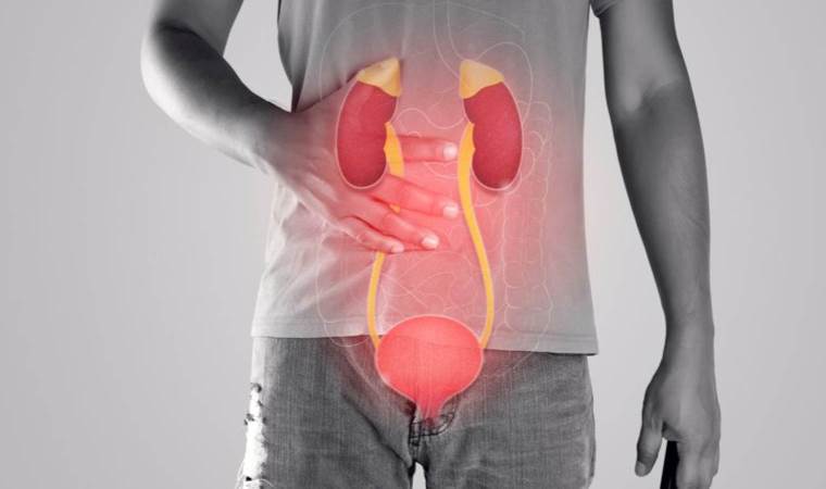 İdrar yolları enfeksiyonu nedir, nasıl geçer? İdrar yolu enfeksiyonuna ne iyi gelir? Evde doğal yollarla idrar yolu iltihabına çözüm üretilir mi?