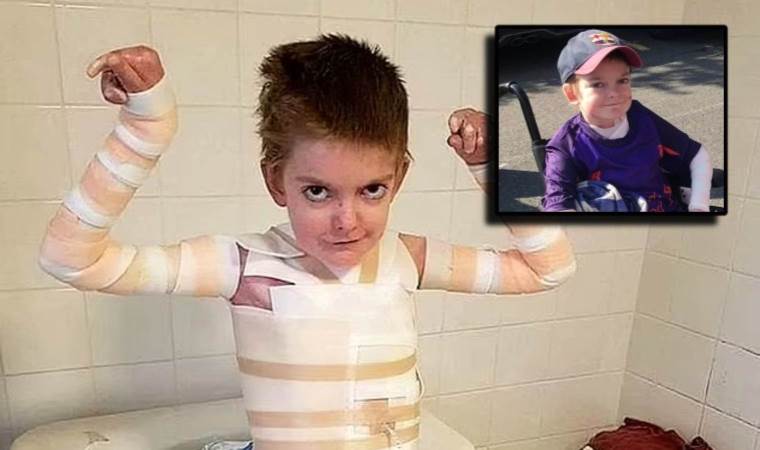 Kelebek hastalığı çocuk yaşta kendi cenazesini planlattı