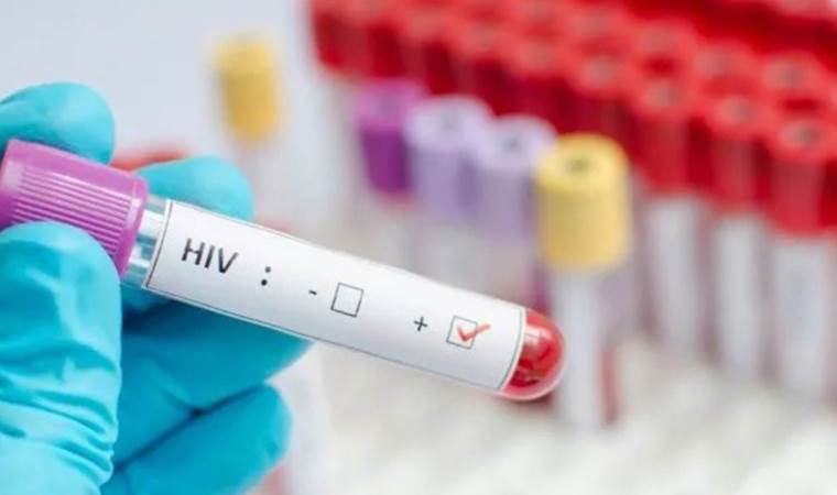 HIV erken tanı ve tedaviyle yönetilebilir bir hastalık