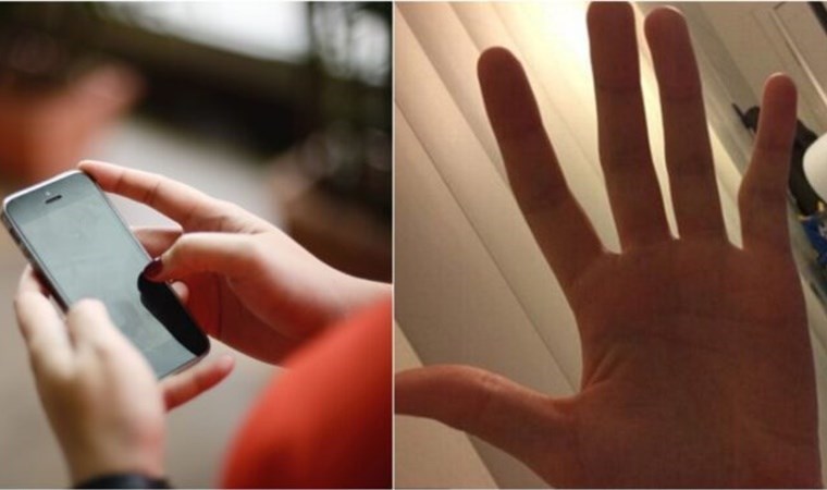 Cep telefonu kullananlara ‘yamuk serçe parmak’ uyarısı: Cerrahi müdahale gerektirebilir!