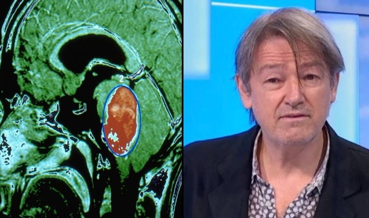 Dünya’da bir ilk: ‘Ölümcül’ hastalıktan nasıl kurtuldu?