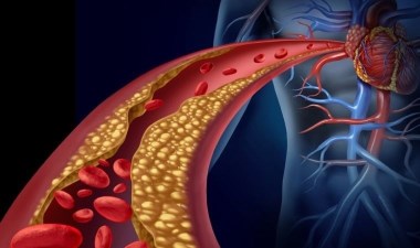 Hareketsiz yaşam atardamar sertleşmesini artırabiliyor – Son Dakika Bilim Teknoloji Haberleri | Cumhuriyet