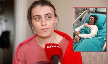 Eltisini bıçaklayıp kaynar suyla yakmıştı: 'Akıl hastası' çıktı – Son Dakika Türkiye Haberleri | Cumhuriyet