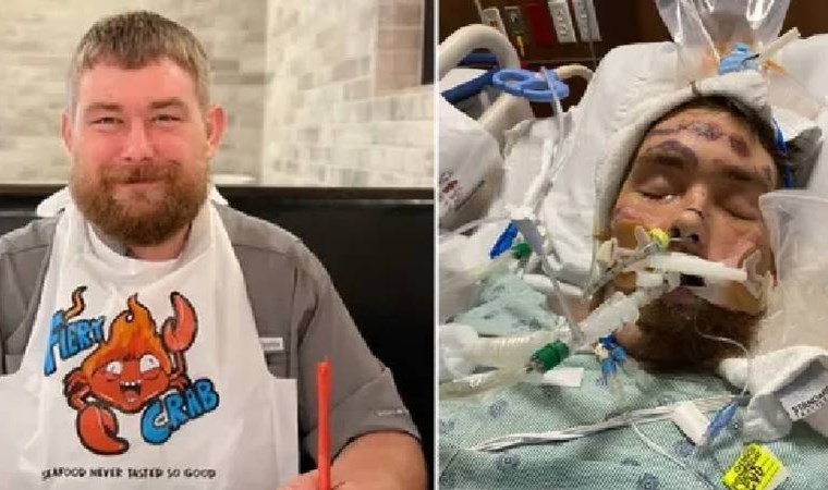 Kıl dönmesini almaya çalıştı: Beyin ölümü gerçekleşti