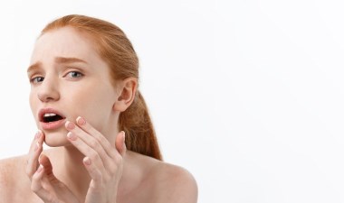 Yüzümüzde pek çok nedenle oluşabiliyor… Kurtulmak için bu 6 altın öneri yeterli! – Son Dakika Yaşam Haberleri | Cumhuriyet