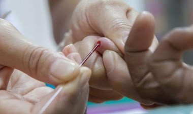 Akdeniz Anemisi (Talasemi) nedir? Akdeniz Anemisi (Talasemi) belirtileri neler? – Son Dakika Sağlık Haberleri | Cumhuriyet