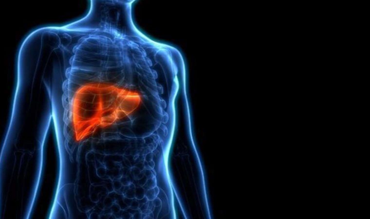 Çağımızın hastalığı: Karaciğer yağlanması