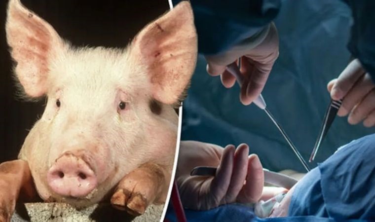 ABD’de, domuz böbreği nakledilen ilk hasta hayatını kaybetti
