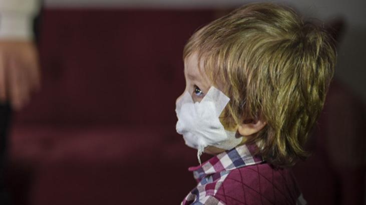 Etimesgut’ta Pitbull Saldırısında Yaralanan Efe 9 Gün Sonra Eve Döndü