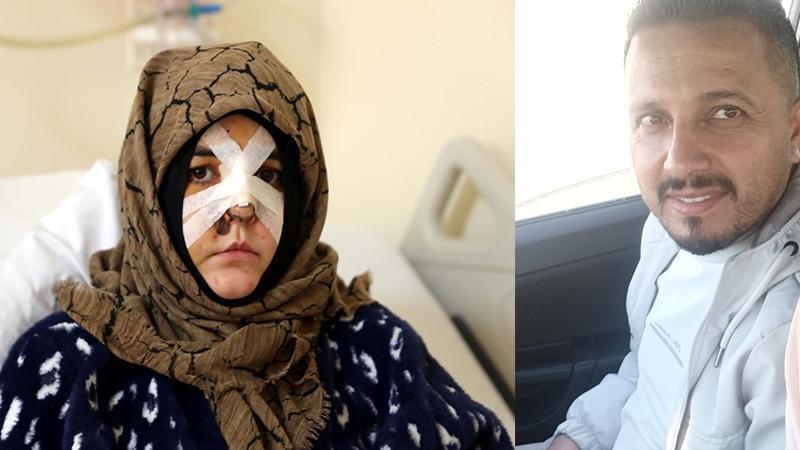 Kaldırım Taşıyla Eşine Saldırı: “Öldürmeye Teşebbüs” Dosyası Ağır Ceza’ya Gönderildi