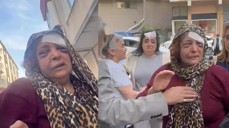 Uzaklaştırma Kararını İhlal Eden Koca Ölü Bulundu, Kayınvalideye Ev Hapsi