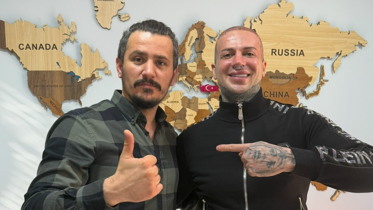 Samet Ergen’in Saç Ekimi Çalışmaları Avrupa’ya Açılıyor: İtalya’dan İstanbul’a Yoğun İlgi