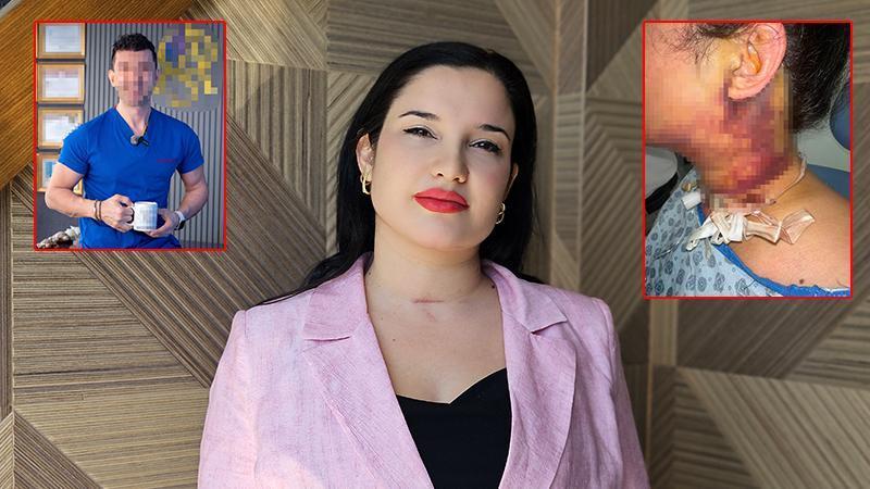 Gonca Uzhan estetik işlem sonrası hastanelik oldu: ‘Acil trakeostomi açıldı’